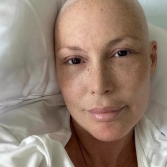 La ex vedette mostró imágenes del tratamiento que realizó en 2023. Foto: Instagram